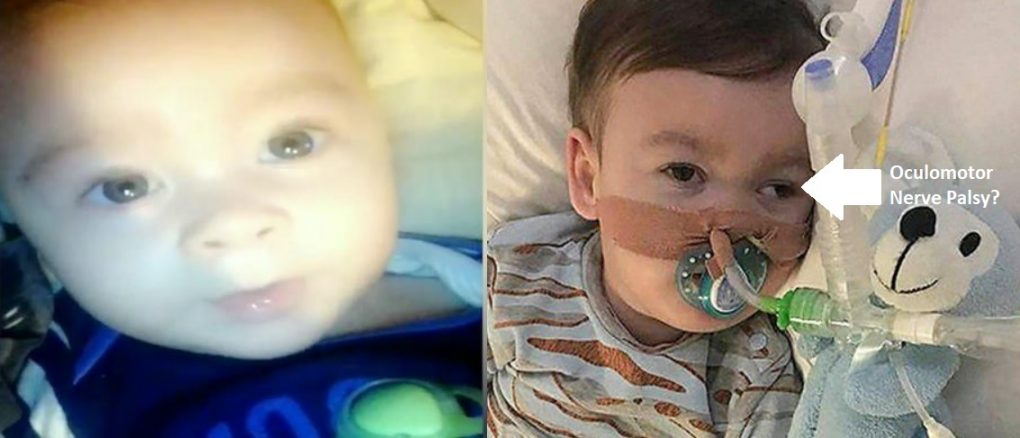 Four Months of Critical Information is Missing from Alfie Evans’ Timeline Alfie-evans-1-1020x438